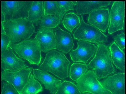Fluoreszenzmikroskopische Aufnahme von NRK-52E-Zellen  nach Americium-Aufnahme.