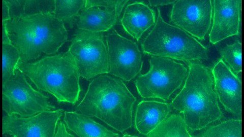 Fluoreszenzmikroskopische Aufnahme von NRK-52E-Zellen  nach Americium-Aufnahme.