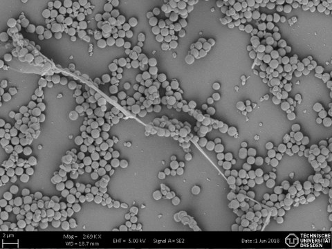Eine mikroskopische Aufnahme zeigt Spermien und Partikel.