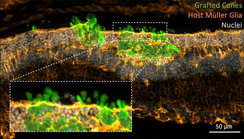 Mikroskopische Aufnahme einer Netzhaut mit implantierten Photorezeptoren.