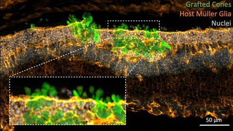 Mikroskopische Aufnahme einer Netzhaut mit implantierten Photorezeptoren.