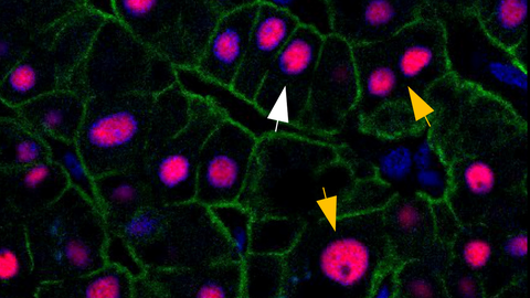Mikroskopische Aufnahme von Leberzellen, rosa markiert.
