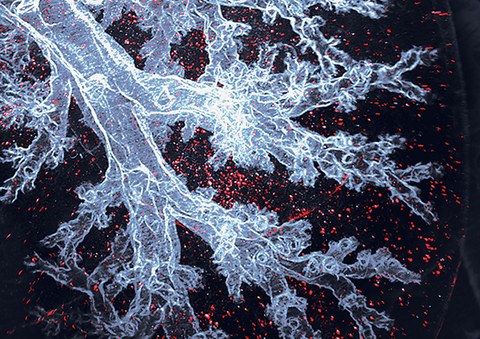 Mikroskopische Aufnahme von Immunmakrophagen der Lunge, weiß/rot auf dunkelblauem Untergrund.