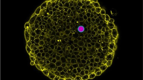 Doppel-Emulsionströpfchen (rosa und cyan) zwischen den Zellen (gelb) eines lebenden Zebrafisch-Embryos. 