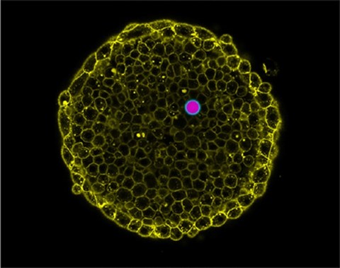 Doppel-Emulsionströpfchen (rosa und cyan) zwischen den Zellen (gelb) eines lebenden Zebrafisch-Embryos. 