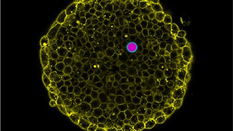 Doppel-Emulsionströpfchen (rosa und cyan) zwischen den Zellen (gelb) eines lebenden Zebrafisch-Embryos. 