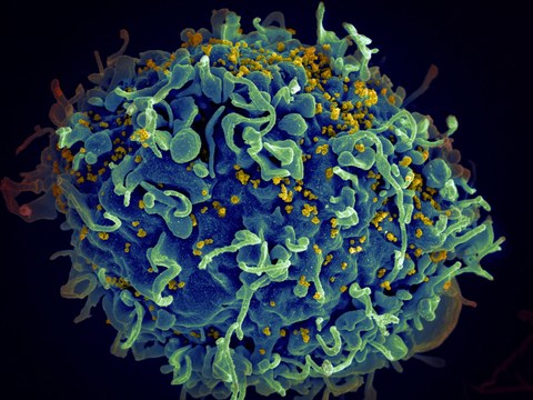 Mikroskopische Aufnahme einer menschlichen Zelle, die durch HIV-Viren infiziert wird.