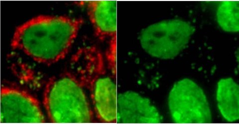 Mikroskopische Gegenüberstellung von Zellen: rechts grün gefärbt, links grün mit rotem Rand