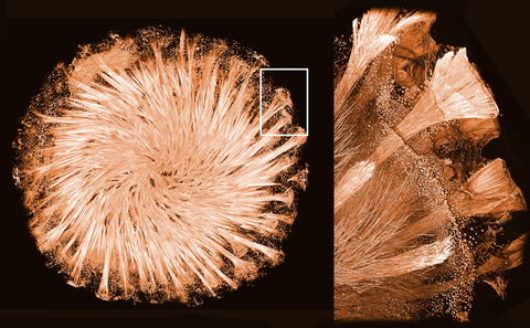 Mikroskopische Aufnahme eines runden Schwammes, links als Gesamtheit ein Ausschnitt ist mit einem weißen Quadrat markiert, rechts ist der vergrößerte Ausschnitt zu sehen.