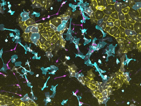 Mikroskopische Aufnahme von Stammzellen. Gefäßzellen sind gelb, Nervenzellen magenta und Bindegewebszellen blau angefärbt.