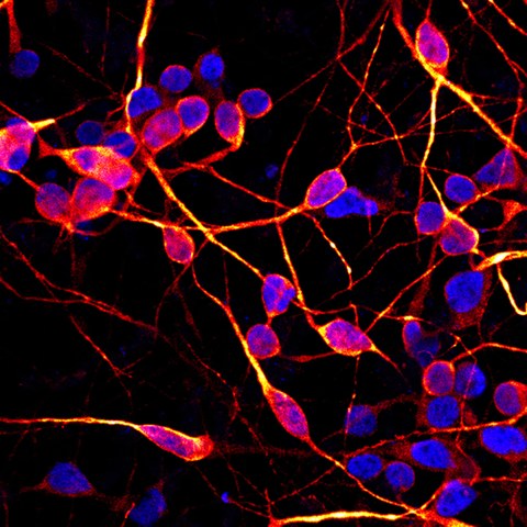To investigate neurodegenerative diseases such as ALS and Parkinson's disease, scientists use induced pluripotent stem cells (iPS cells) 