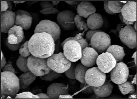 Elektronenmikroskopische Aufnahme von Methanogenen 