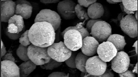 Elektronenmikroskopische Aufnahme von Methanogenen 