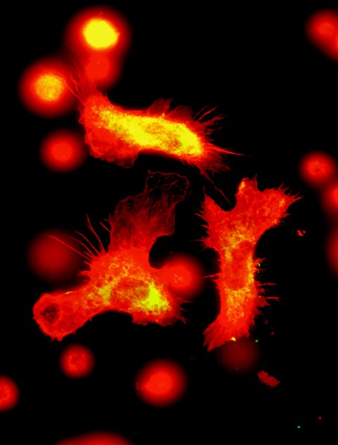 Immunzellen unter dem Fluoreszenzmikroskop