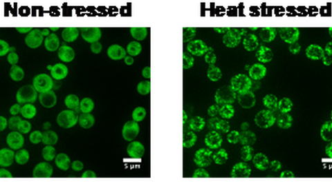 Mikroskopische Aufnahme von Proteinen der Backhefe gestresst und nicht gestresst.