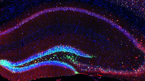 Neurale Stammzellen der Maus