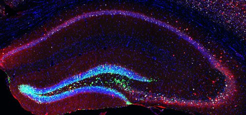 Neurale Stammzellen der Maus