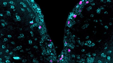 Fluoreszenz-Mikroskopaufnahme von Gehirnzellen des Zebrafisches: Neugebildete Neuronen haben Magenta gefärbte Kerne und sind von türkisen Zellkörpern umgeben