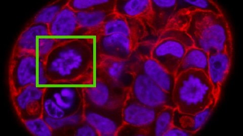 Mikroskopische Aufnahme eines Minitumors, im linken oberen Bildrand ist mit grün eine sich teilende Zelle markiert.