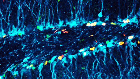 Mikroskopische Aufnahme von Neuronen in Blautönen