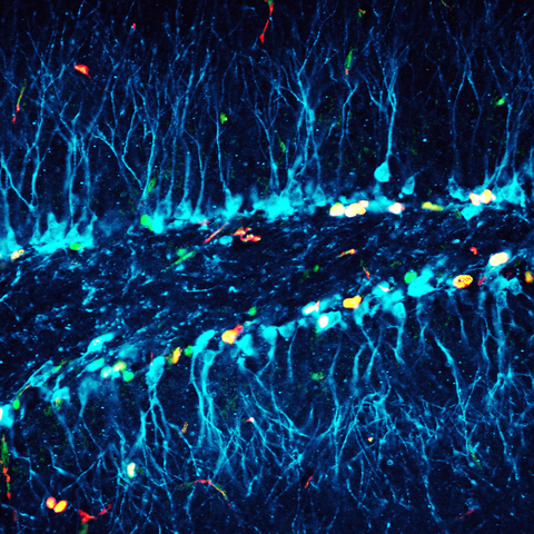 Mikroskopische Aufnahme von Neuronen in Blautönen