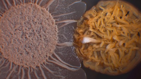 Rechts eine runde, sehr strukturierte Zellkultur in dunklem Orange, rechts sonnenförmig in altrosa. Der Hintergrund ist schwarz