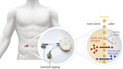 Wirkungsweise des Bioreaktors 