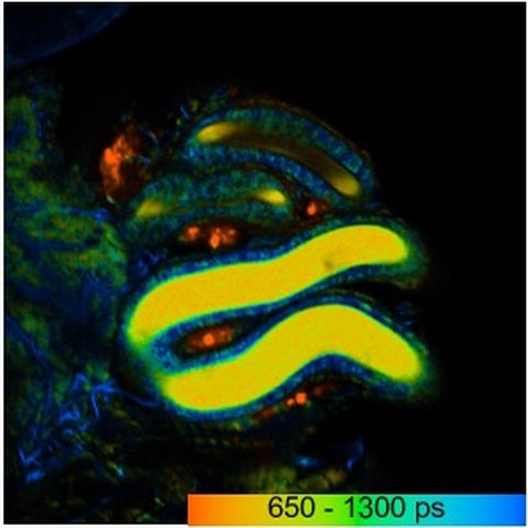 Falschfarbenbild der Fluoreszenz-Lebenszeit des Stoffwechselmoleküls NADH eines Spermienhaufens (hier gelb) in einem weiblichen Spermienspeicherorgan in der Taufliege. 