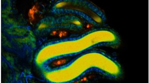 Falschfarbenbild der Fluoreszenz-Lebenszeit des Stoffwechselmoleküls NADH eines Spermienhaufens (hier gelb) in einem weiblichen Spermienspeicherorgan in der Taufliege. 