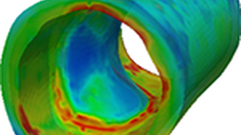 Simulation Arterie