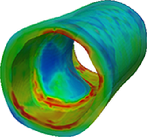 Simulation Arterie