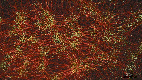 Vergrößertes Foto von emergentem Verhalten in der Zellhülle: Aktinfilamente und Myosin-Motorproteine erzeugen die Kräfte, die Zellen, Gewebe und Organismen formen.