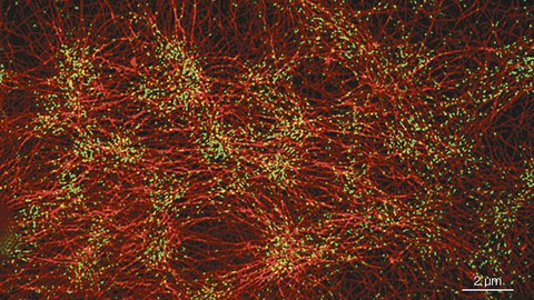 Vergrößertes Foto von emergentem Verhalten in der Zellhülle: Aktinfilamente und Myosin-Motorproteine erzeugen die Kräfte, die Zellen, Gewebe und Organismen formen.