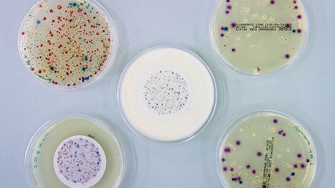 Aus der Wasserprobe einer Kläranlage isolierte Bakterien auf ESBL-Agar: E.coli, Klebisella und Acenetobacter/Pseudomonas.