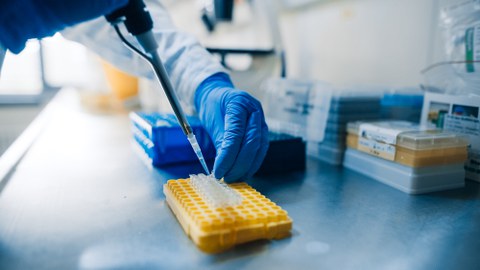 Foto: Hand mit blauen Handschuhen pipettiert Flüssigkeit in eine gelbe Laborplatte auf einem Labortisch.