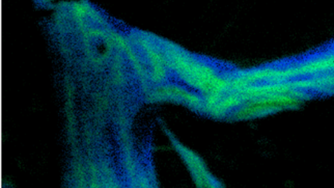 Knochenstruktur im osteoporotischen Schafmodell. ToF-SIMS Massenbild eines einzelnen Knochenbälkchens, das in grün die Calciumverteilung und in blau die Kollagenverteilung zeigt. 