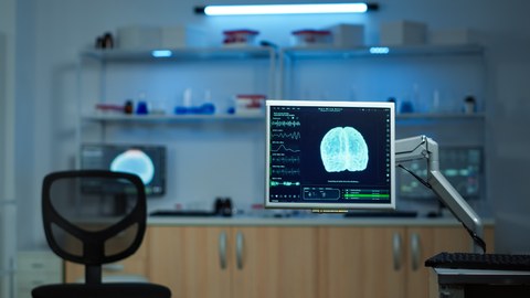 Photo of a medical laboratory. In the foreground is a monitor on which a brain scan is shown.