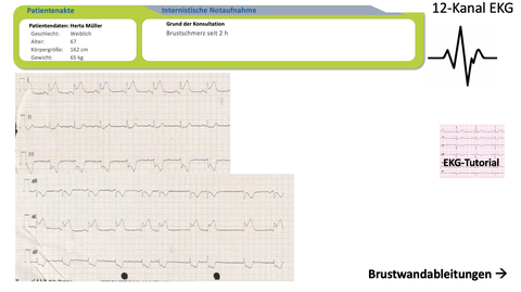 im E-Learning angezeigte 12-Kanal-EKG 