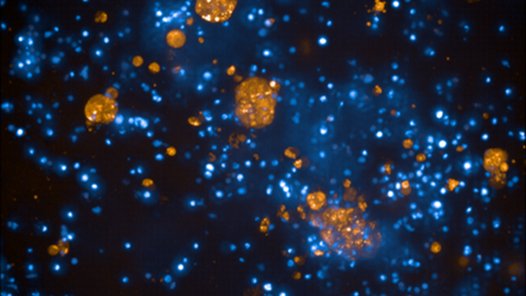 Microscopic image showing numerous glowing blue and orange dots and cellular structures against a dark background. The differently sized orange clusters stand out clearly from the finely distributed blue structures.