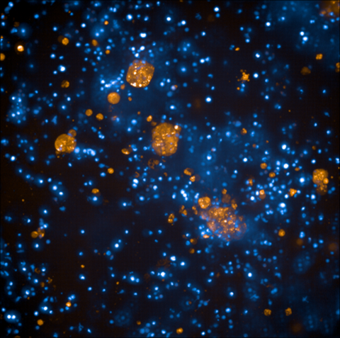 Mikroskopische Aufnahme mit zahlreichen leuchtend blauen und orangefarbenen Punkten und Zellstrukturen auf dunklem Hintergrund. Die unterschiedlich großen, orange markierten Cluster heben sich deutlich von den fein verteilten blauen Strukturen ab.
