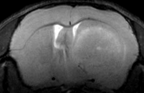 T2-gewichtete MRT-Aufnahme eines Maushirns mit deutlich sichtbarem Tumorgewebe.